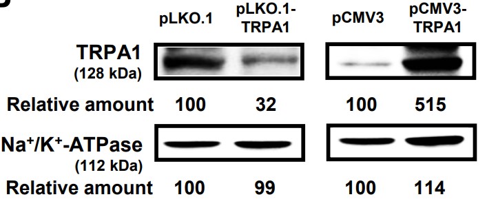 Plasmids for knockdown or overexpression of TRPA1 were transfected into A549 cells.jpg